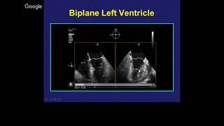 Echocardiography for Surgeons Part IV The Aortic Valve Other Structures and 3D Imaging [upl. by Schwerin657]