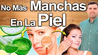 Porqué Tengo Manchas  Causas Y Soluciones Para Eliminar Manchas En Cara Brazos Y Cuerpo [upl. by Ibbed68]