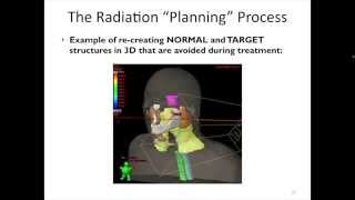 Late Stage Oropharynx Cancer Planning Radiotherapy [upl. by Sussman]