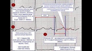 Prosty sposób obliczania QTc w EKG [upl. by Naasar]