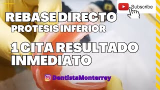 REBASE DIRECTO ğŸ‘… PrÃ³tesis INFERIOR 1Cita [upl. by Rusty]