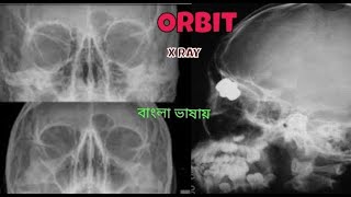 Technique of Orbit x ray positioning  Radiography  কনিকা মেশিন এক্সরে [upl. by Irbua756]