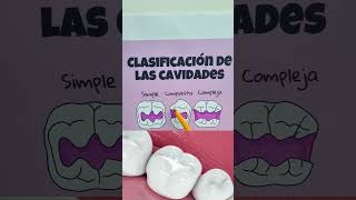 ¿Por que mi dentista elige entre resina incrustación o corona ¿Cuál es la mejor opción para mi [upl. by Sanborne]