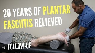 20 Years of Plantar Fasciitis RELIEVED With ASTR FOLLOWUP [upl. by Yendis112]