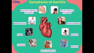 Aortitis Symptoms and Causes  Diagnosis  Treatment  Prevention [upl. by Eelynnhoj]