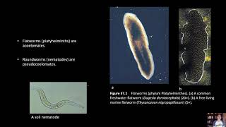 BIOL 1407 Lab 37 Platyhelminthes [upl. by Aniral]