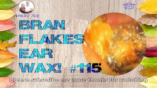 BRAN FLAKES EAR WAX 115 ear earwax earwaxremoval asmr satisfying [upl. by Hallock]