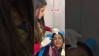 Botox Treatment For Face  Botox Injection  Dr Muskan Tyagi  Dermalyn Aesthetics [upl. by Faythe]