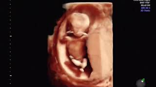 fetal ultrasound of 12 weeks baby boy moving 3D [upl. by Gustaf]