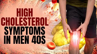 Cholesterol Leg Symptoms Warning Signs Of High Bad Cholesterol Levels [upl. by Wampler148]