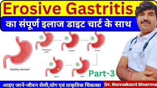 Erosive Gastritis Complete Diet Exercises and Treatmentdrramakantsharma7 [upl. by Mitch511]