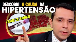 Como Achei a CAUSA da Hipertensão do Paciente no Exame de Sangue [upl. by Doolittle]