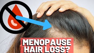 Does MENOPAUSE Cause HAIR LOSS Find out [upl. by Eidnew]