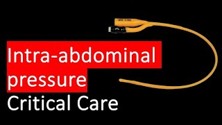 HOW and WHY do we measure intra abdominal pressure [upl. by Folsom593]