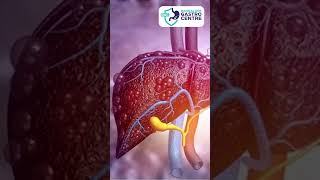 The SHOCKING Truth About Fatty Liver Symptoms [upl. by Nitsrik345]