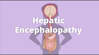 Cirrhosis – Hepatic encephalopathy [upl. by Perretta356]