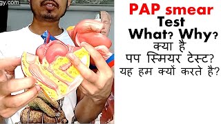 Pap smear test in Hindi [upl. by Anerys266]