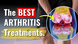 Knee Arthritis Treatments Proven to Work  The Truth You Need to Know [upl. by Eillod650]