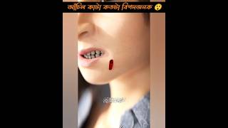 Alert 🚨 আঁচিল কতটা বিপদজনক ।। Mole Removal mayajaalbangla shortsviral shortvideos [upl. by Stefa]