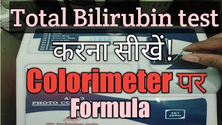 Bilirubin test in Colorimeter Bilirubin test procedure in Colorimeter [upl. by Suired932]