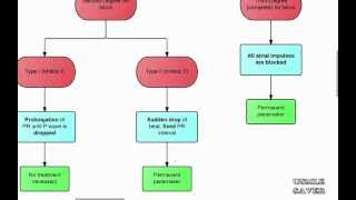 Arrhythmias Flowchart USMLE Step 2 CK [upl. by Iemaj449]