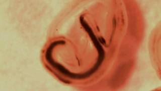 Parasitic Worms Having Sex [upl. by Bail]