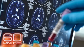 Alzheimers and Dementia  60 Minutes Full Episodes [upl. by Yevette357]