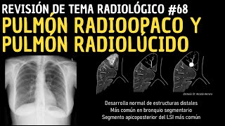 Revisión de Tema 68 Pulmón radioopaco y pulmón radiolúcido [upl. by Huckaby]