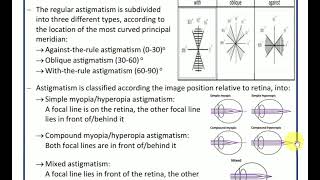 chp 10 optics of ametropia [upl. by Nylime]