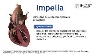 Impella [upl. by Ruella]