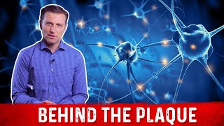 What is Plaque and How to Remove it Explained By Dr Berg [upl. by Gnuj]