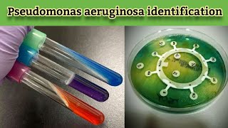 Practical work Pseudomonas aeruginosa Identification and confirmatory biochemical tests English [upl. by Crandell36]