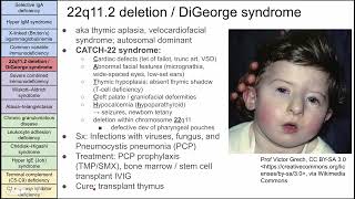 Primary immunodeficiency disorders [upl. by Releyks]