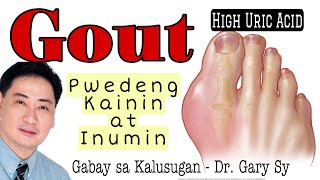 GOUT PWEDENG Kainin at Inumin  Dr Gary Sy [upl. by Atenik]