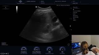 Analisando o Ultrassom do Abdome  Finus 55 [upl. by Chane]