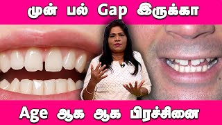 முன் பல் Gap இருக்கா Age ஆக ஆக பிரச்சினை  Health Times Now  Teeth Gap  Dental [upl. by Fendig]