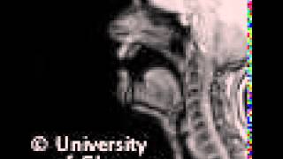 MRI voiced bilibial implosive [upl. by Eneroc]