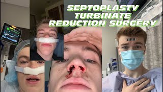 Septoplasty Turbinate Reduction Surgery Recovery vlog  tips ￼ [upl. by Yentiw903]