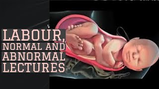 LABOUR lecture 6 MANAGEMENT OF STAGES OF LABOUR and Partogram remaining points [upl. by Arun647]