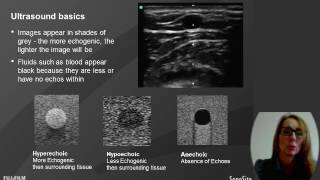 Webinar Ultrasound in Hemodialysis Assessment amp USGuided Cannulation for Dialysis Nurses [upl. by Regan361]