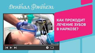 Как проходит лечение зубов в наркозе❓🦷 Смотрите видео до конца🙌🏻 Задавайте ваши вопросы☺️ [upl. by Gridley811]