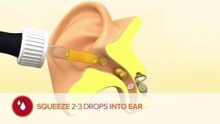 How to use Otex Olive Oil Ear Drops [upl. by Herstein815]