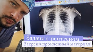 Xray practice Практика по рентгенуПосмотрите на рентген и установите диагноз [upl. by Hanauq]