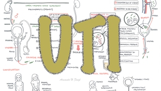 Urinary Tract Infection  Overview signs and symptoms pathophysiology causes and treatment [upl. by Ititrefen699]