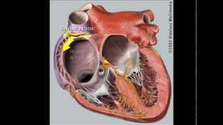 What is Supraventricular Tachycardia SVT [upl. by Ytima]