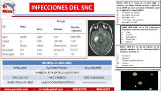 QX MEDIC MENINGITIS Y CEFALEA [upl. by Avla]