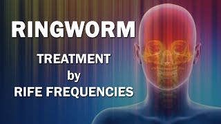 Ringworm  RIFE Frequencies Treatment  Energy amp Quantum Medicine with Bioresonance [upl. by Aynor]