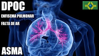 DPOC  Doença Pulmonar Obstrutiva Crônica  ASMA  FALTA DE AR  Enfisema Pulmonar [upl. by Ihtak399]