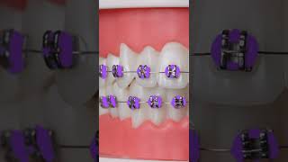 100 combinaciones de colores para tus BRACKETS [upl. by Ladew982]