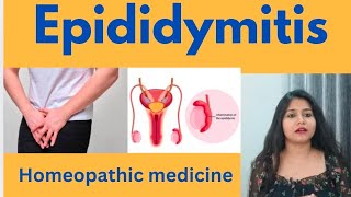 Epididymitis treatment  Epididymitis symptomscauses amp homeopathic medicine in hindi [upl. by Drislane331]